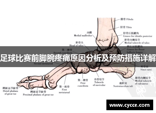足球比赛前脚腕疼痛原因分析及预防措施详解